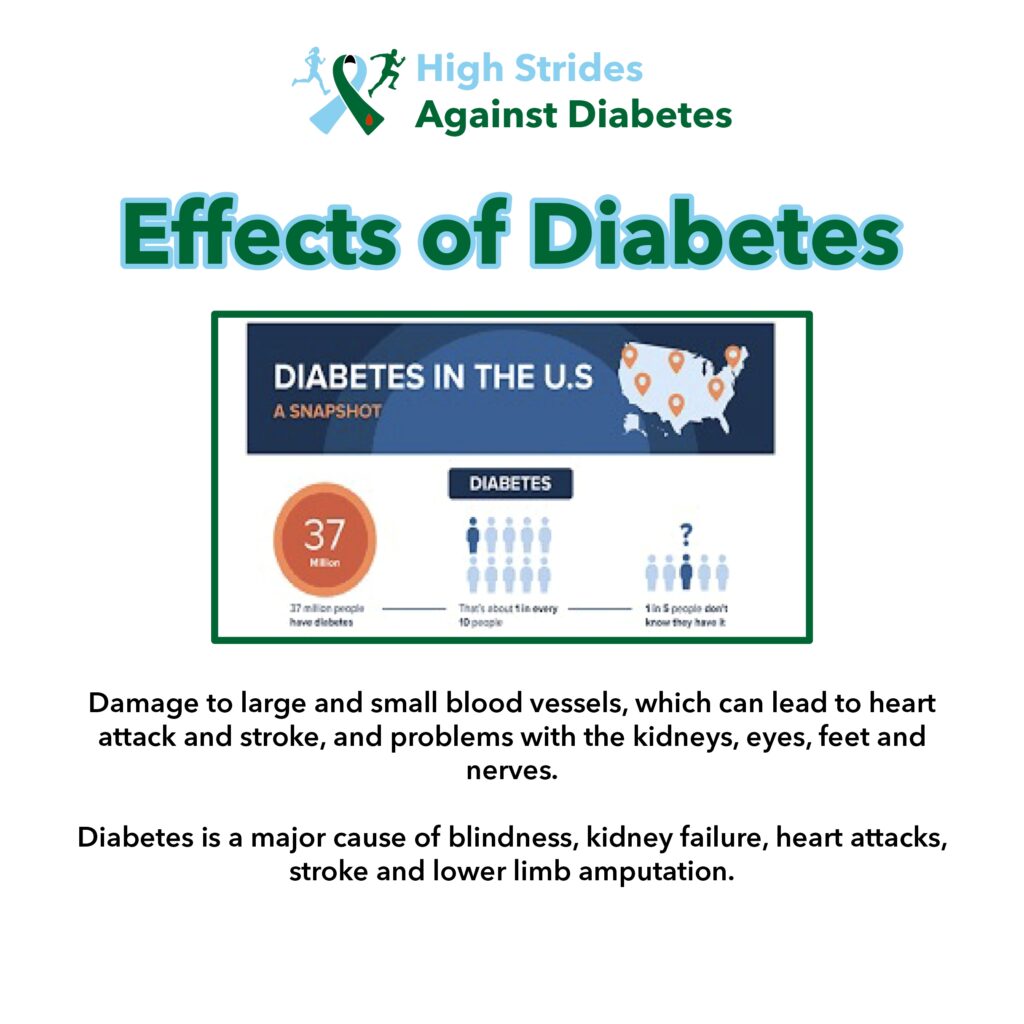 Diabetes in US